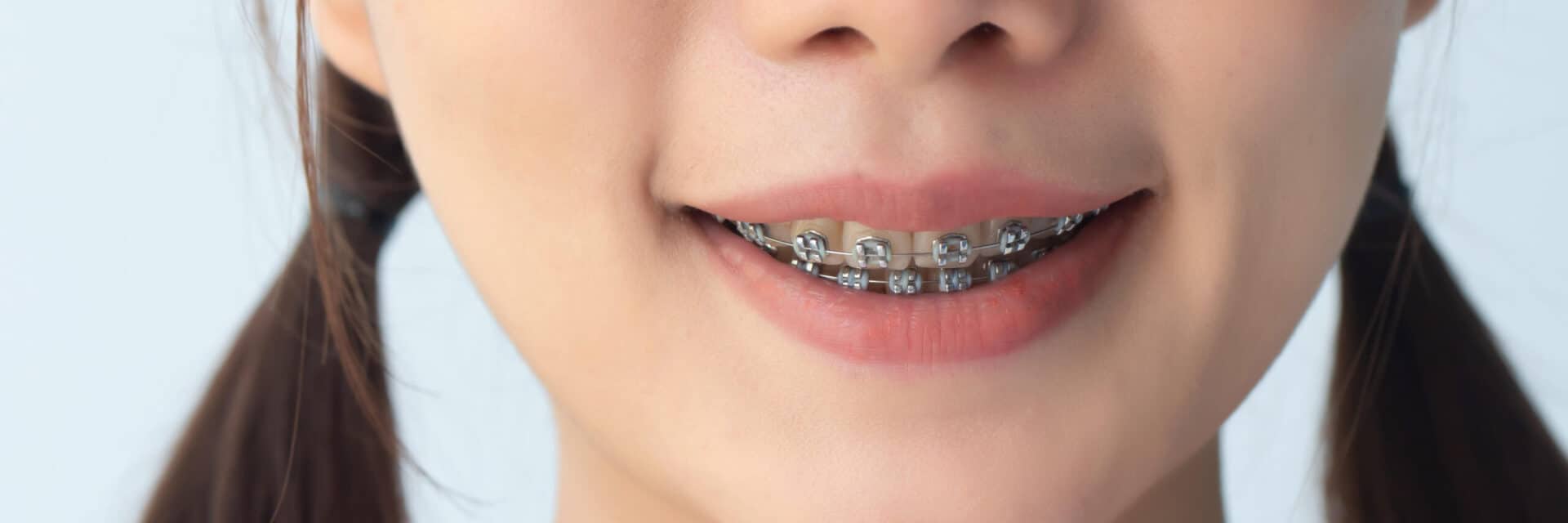 close up on a young girl's braces