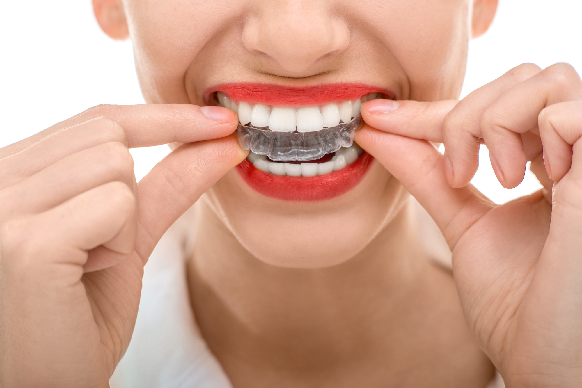 Top 5 Reasons to Visit a Family Orthodontist